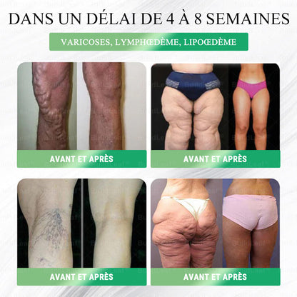 Woomp® 𝗚𝗟𝗣-𝟭 𝟖-en-𝟭 𝗦𝗹𝗶𝗺 & 𝗛𝗲𝗮𝗹𝘁𝗵𝐲 𝗦𝗼𝗹𝘂𝘁𝗶𝗼𝗻 𝗼𝗿𝗮𝗹𝗲( 𝑟é𝑠𝑢𝑙𝑡𝑎𝑡𝑠 𝑣𝑖𝑠𝑖𝑏𝑙𝑒𝑠 𝑒𝑛 7 𝑗𝑜𝑢𝑟𝑠)✅ 𝗦𝗼𝘂𝘁𝗶𝗲𝗻 𝗽𝗼𝘂𝗿 𝗹’𝗼𝗯é𝘀𝗶𝘁é, 𝗹𝗲 𝗱𝗶𝗮𝗯è𝘁𝗲, 𝗹𝗮 𝘀𝗮𝗻té 𝗶𝗻𝘁𝗲𝘀𝘁𝗶𝗻𝗮𝗹𝗲 𝗲𝘁 𝗹𝗲𝘀 𝗽𝗿𝗼𝗯𝗹è𝗺𝗲𝘀 𝗮𝘂𝘅 𝗮𝗿𝘁𝗶𝗰𝘂𝗹𝗮𝘁𝗶𝗼𝗻𝘀, 𝘁𝗼𝘂𝘁 𝗲𝗻 𝗳𝗲𝗿𝗺𝗮𝗻𝘁 𝗹𝗮 𝗽𝗲𝗮𝘂 𝗲𝘁 𝗲𝗻 𝗮𝘂𝗴𝗺𝗲𝗻𝘁𝗮𝗻𝘁 𝗹’é𝗻𝗲𝗿𝗴𝗶𝗲.