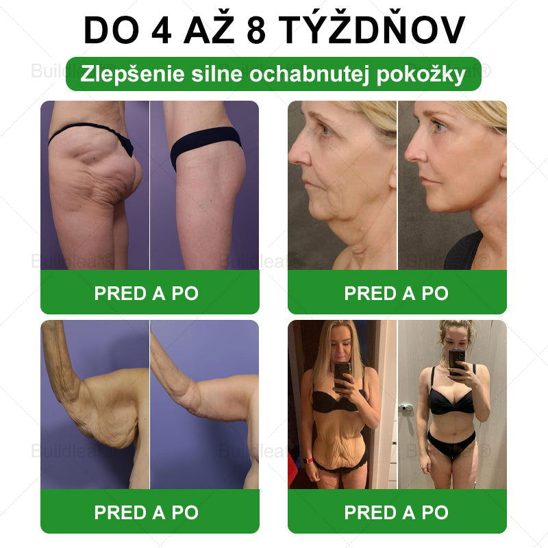 🪻🪻BuildLeaf® GLP-1 8-v-1 Fit & Vital Perorálny Roztok ✅(Len raz denne, viditeľné zmeny už za 7 dní) Pre obezitu, kardiovaskulárne ochorenia, cukrovku, problémy so štítnou žľazou, zdravie čriev, problémy s kĺbmi a ďalšie