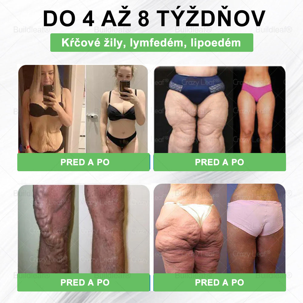 🪻🪻BuildLeaf® GLP-1 8-v-1 Fit & Vital Perorálny Roztok ✅(Len raz denne, viditeľné zmeny už za 7 dní) Pre obezitu, kardiovaskulárne ochorenia, cukrovku, problémy so štítnou žľazou, zdravie čriev, problémy s kĺbmi a ďalšie